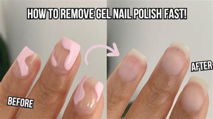 Can you soak off gel nails with non acetone?