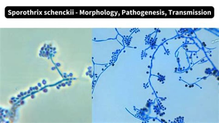 What are the characteristic morphological features of the fungus Sporothrix schenckii?