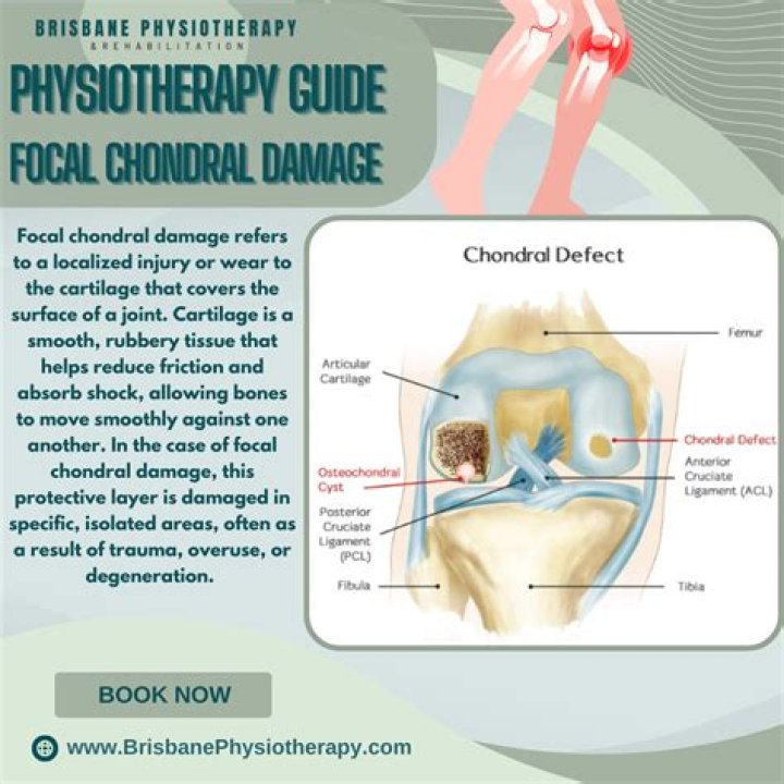 What is a chondral fissure?
