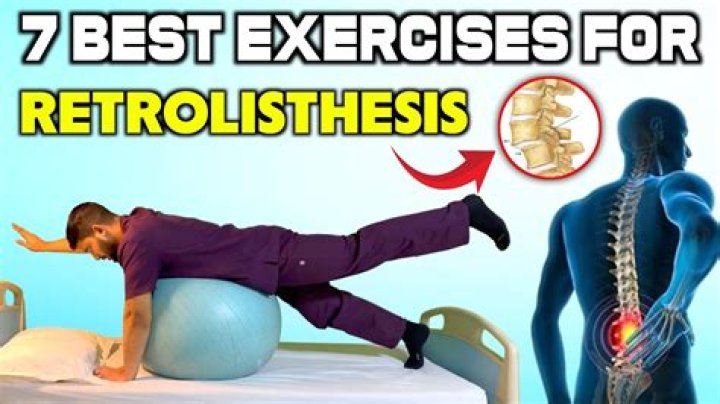 What is the best exercise for Retrolisthesis?