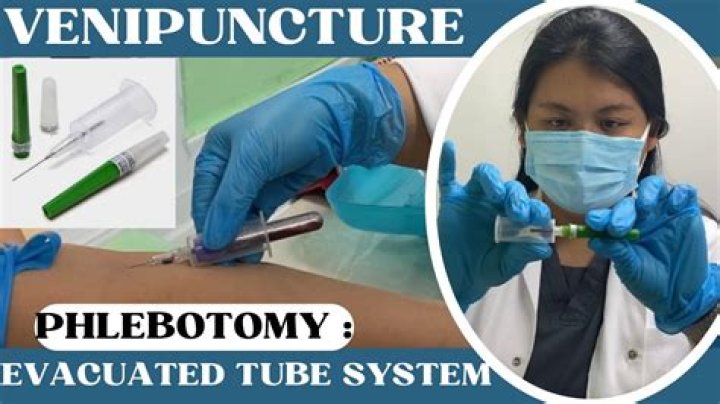 What is the procedure of evacuated tube system?