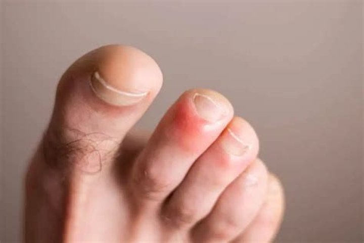 Why is my toe red and sore?